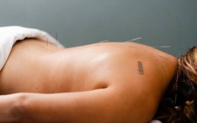 Benefits of Acupuncture: A New Way to Support Your Wellness