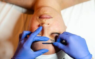 What Is Dermaplaning?