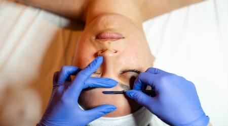 What Is Dermaplaning?
