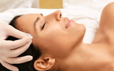 The Benefits of Cosmetic Acupuncture for Radiant, Healthy Skin