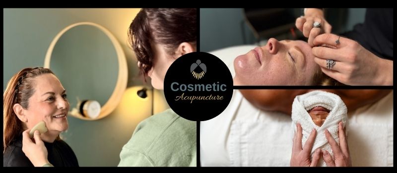 Cosmetic Acupuncture Process at Firefly Spa, San Diego