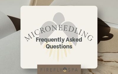 Microneedling Frequently Asked Questions Answered