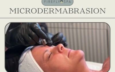 Microdermabrasion: What It Is and Why Your Skin Loves It