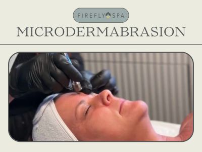 Esthetician performing microdermabrasion on a Firefly Spa client in San Diego.