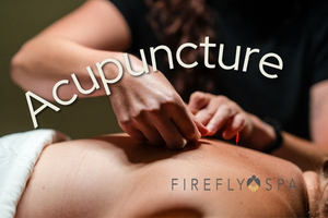Person receiving acupuncture at Firefly Spa in San Diego.