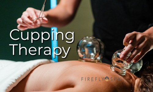 Client receives cupping therapy during a massage at Firefly Spa in San Diego. 