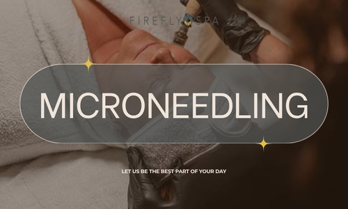 Microneedling at Firefly Spa in San Diego.